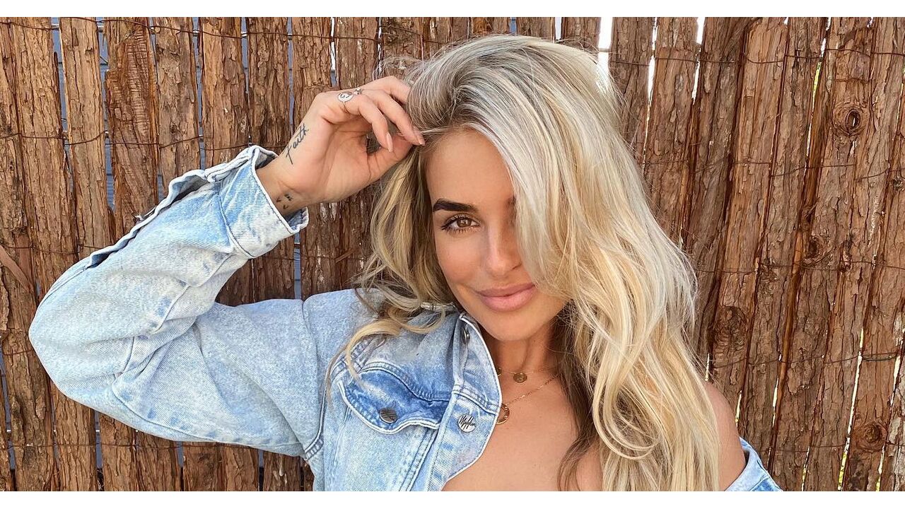 gaby-blaaser-zwangerschap-botox