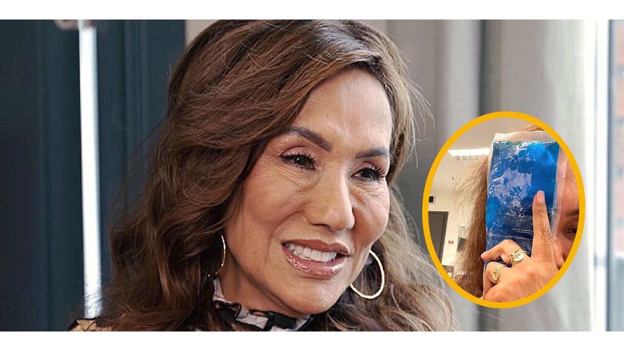 Illustratie voor: Foto: Patty Brard met opgezwollen gezicht naar het ziekenhuis